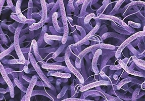 شناسایی 79 مبتلا به وبا در سال گذشته/کاهش چشمگیر آمار بیماری